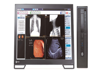 医療用画像管理システム(PACS)